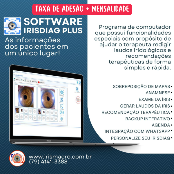 TAXA DE ADESÃO - IrisDiag Plus - 2025 - Licença Mensal - Com Integração ao WhatsApp 
