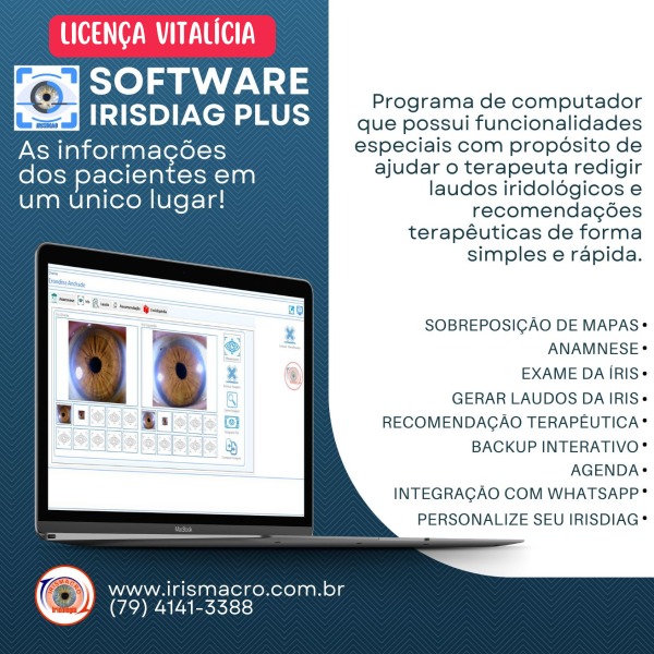 IrisDiag Plus - Versão 2025 - Licença vitalícia - Com Integração ao WhatsApp 