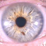 Irismacro 4k  - série USB4K2025 - iridoscopio iridologia, irisdiagnose.